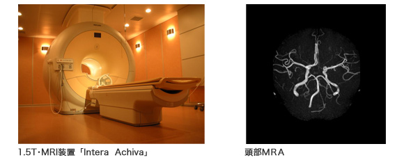 1.5T・MRI装置 頭部MRA