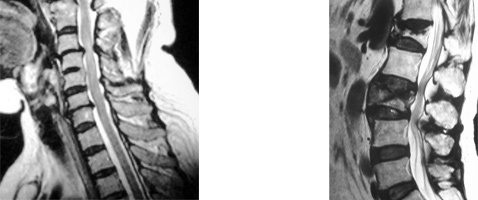 脊髄・脊椎の画像
